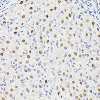DYNLL1 Rabbit Polyclonal Antibody