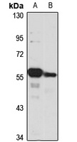 EDC3 Rabbit Polyclonal Antibody