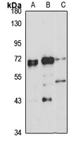 EED Rabbit Polyclonal Antibody