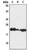 EEF1E1 Rabbit Polyclonal Antibody