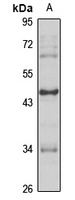 EGR3 Rabbit Polyclonal Antibody