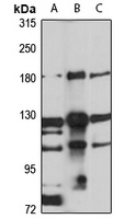 EHBP1 Rabbit Polyclonal Antibody