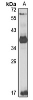 eIF3 beta Antibody