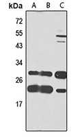 eIF4H Rabbit Polyclonal Antibody