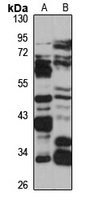 ENPP6 Rabbit Polyclonal Antibody