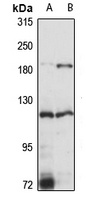 EPAS1 Antibody