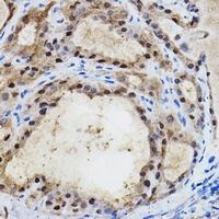 EPAS1 Antibody