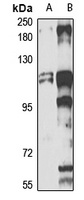PICH Antibody