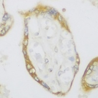 SPFH1 Rabbit Polyclonal Antibody