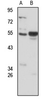 ERVW-1 Rabbit Polyclonal Antibody