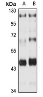 PAR2 Rabbit Polyclonal Antibody