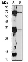 FAM64A Rabbit Polyclonal Antibody
