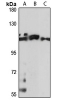FAM65B Rabbit Polyclonal Antibody