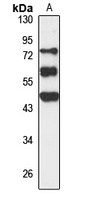FAM83A Rabbit Polyclonal Antibody