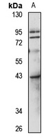 FBLIM1 Rabbit Polyclonal Antibody
