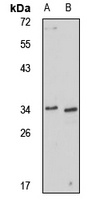 Ficolin 2 Rabbit Polyclonal Antibody