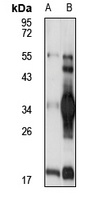Ficolin 3 Rabbit Polyclonal Antibody