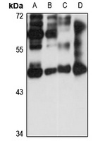 HYPE Rabbit Polyclonal Antibody