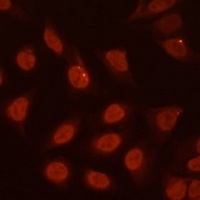 BF-1 Rabbit Polyclonal Antibody