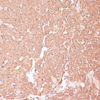 FRMD6 Rabbit Polyclonal Antibody
