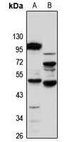 FUCA1 Rabbit Polyclonal Antibody