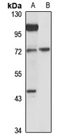FUT8 Rabbit Polyclonal Antibody