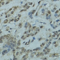 GABPA Antibody