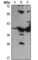 GALM Rabbit Polyclonal Antibody