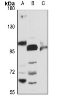 Beta-glucosidase 2 Rabbit Polyclonal Antibody