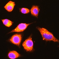 GBP2 Rabbit Polyclonal Antibody