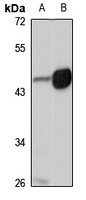 BMP9 Rabbit Polyclonal Antibody