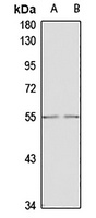 GDF5 Rabbit Polyclonal Antibody