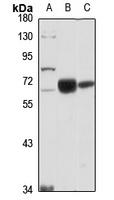 GLS2 Rabbit Polyclonal Antibody