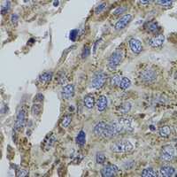 G alpha 15 Rabbit Polyclonal Antibody