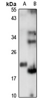 GOLGA7 Rabbit Polyclonal Antibody