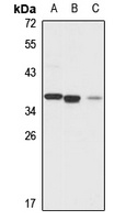 GOLPH3 Rabbit Polyclonal Antibody