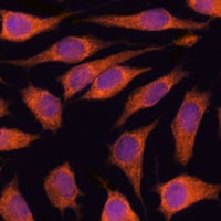 GOLPH3 Rabbit Polyclonal Antibody