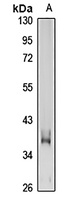 GP6 Antibody