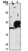 GPD1L Rabbit Polyclonal Antibody