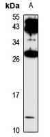 GPA2 Rabbit Polyclonal Antibody