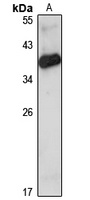 GRAP Rabbit Polyclonal Antibody