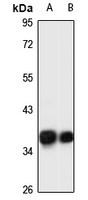 GRHPR Rabbit Polyclonal Antibody