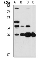 GSTA3 Rabbit Polyclonal Antibody