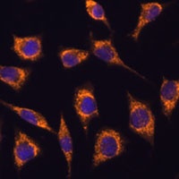 GSTA3 Rabbit Polyclonal Antibody