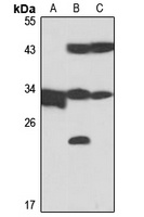 GSTO1 Rabbit Polyclonal Antibody
