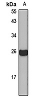 MAAI Rabbit Polyclonal Antibody