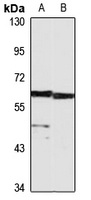 HAS1 Rabbit Polyclonal Antibody