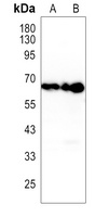 HAS2 Rabbit Polyclonal Antibody