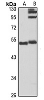 HICE1 Rabbit Polyclonal Antibody