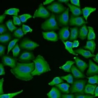 HICE1 Rabbit Polyclonal Antibody